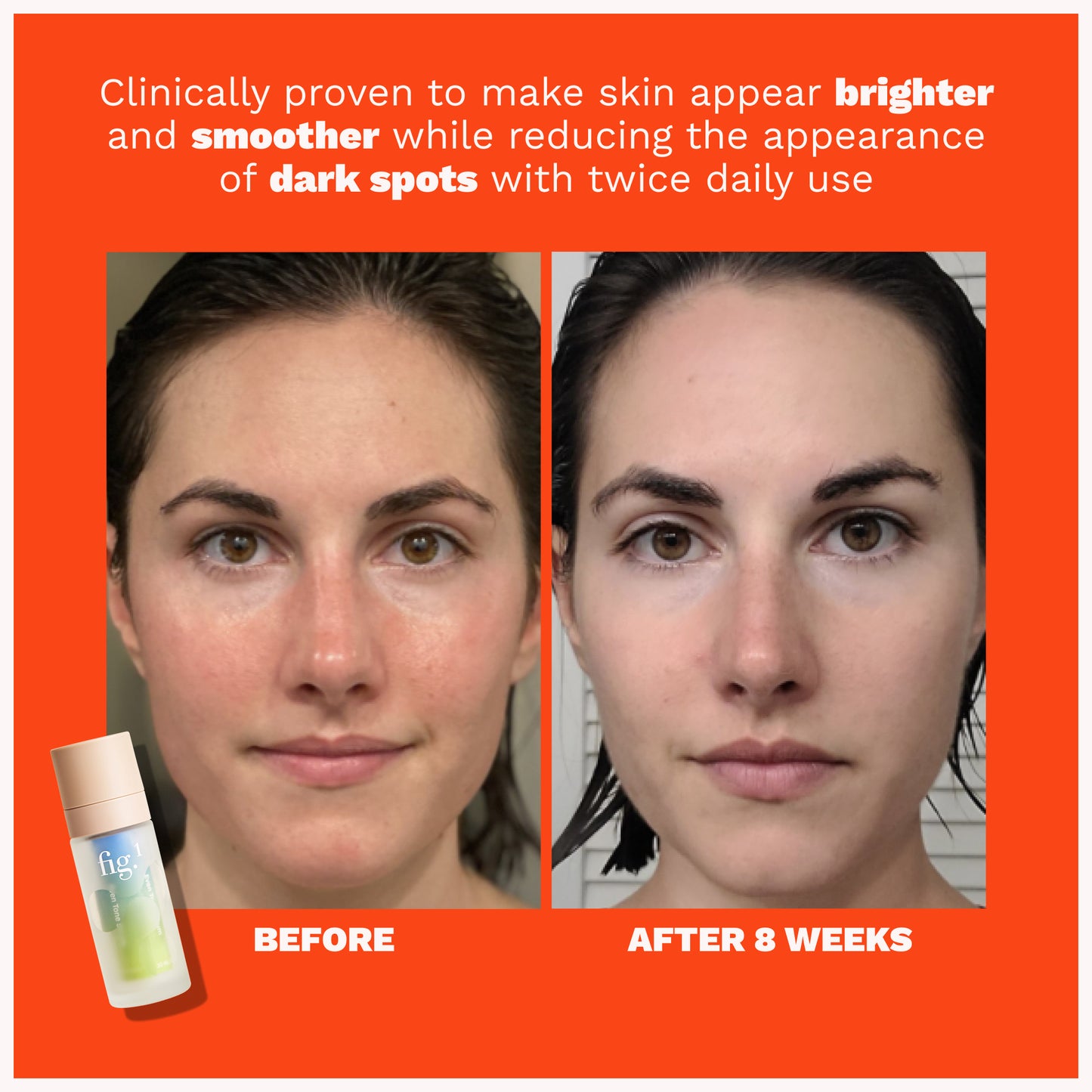 Even Tone Serum