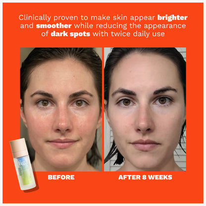 Even Tone Serum