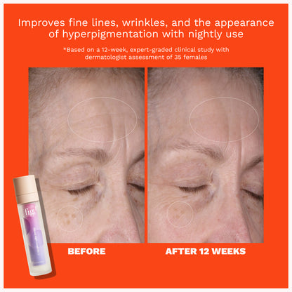 Retinol Night Cream Level 2